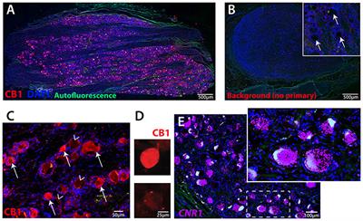 Cannabinoid Receptor 1 Expression in Human Dorsal Root Ganglia and CB13-Induced Bidirectional Modulation of Sensory Neuron Activity